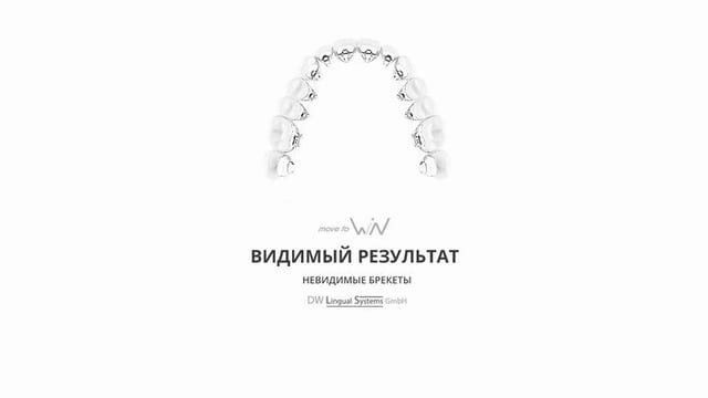 Лингвальные брекеты - незаметное и комфортное решение ортодонтических проблем!