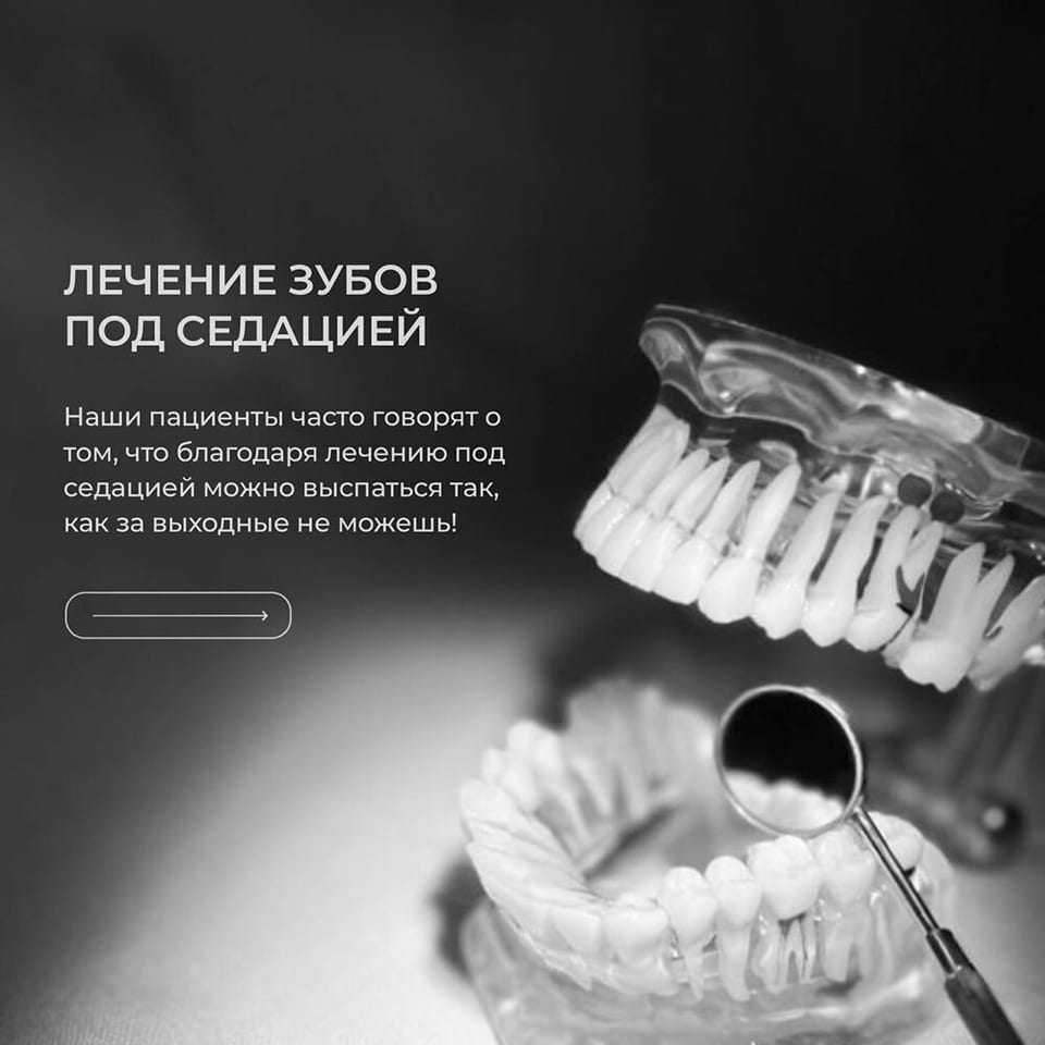 Седация для взрослых
