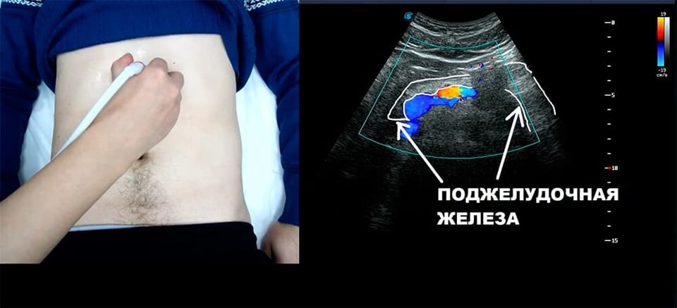 УЗИ поджелудочной железы